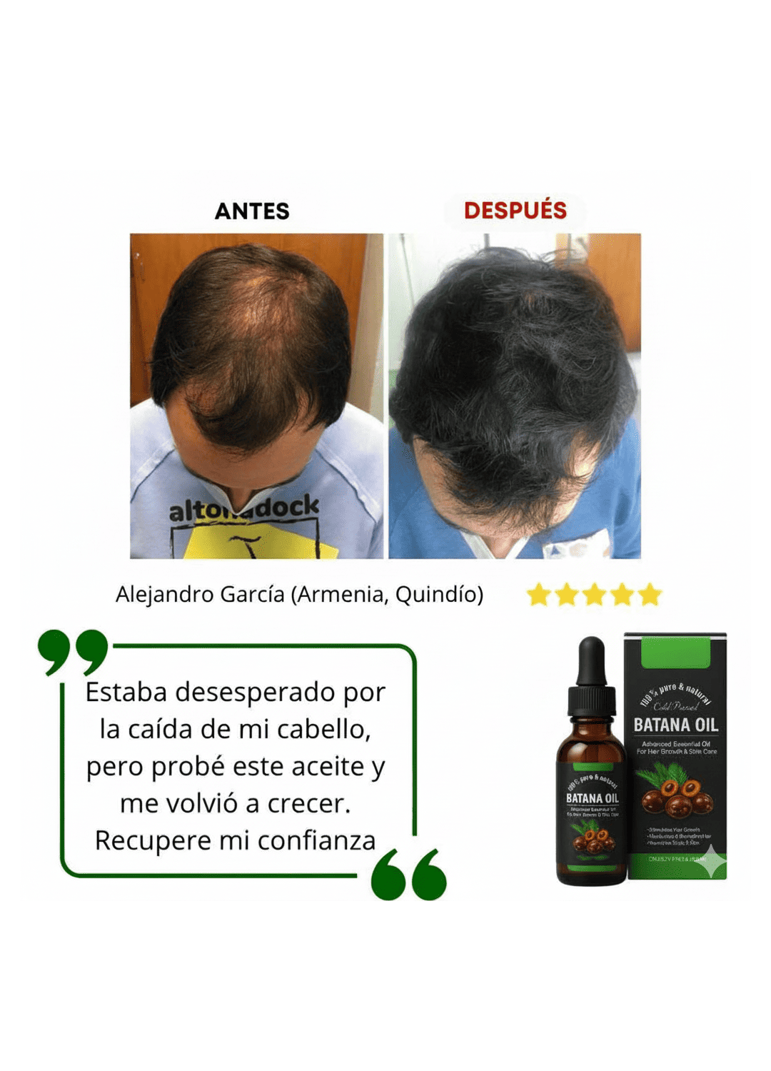 ACEITE CAPILAR DE BATANA-ROMERO